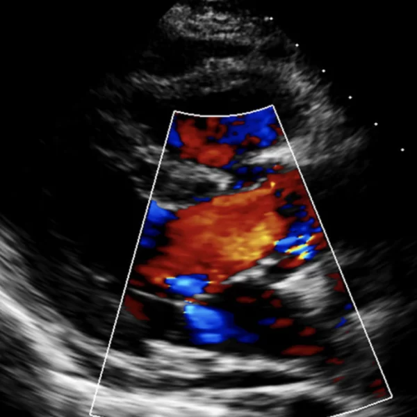 Echocardiography 3