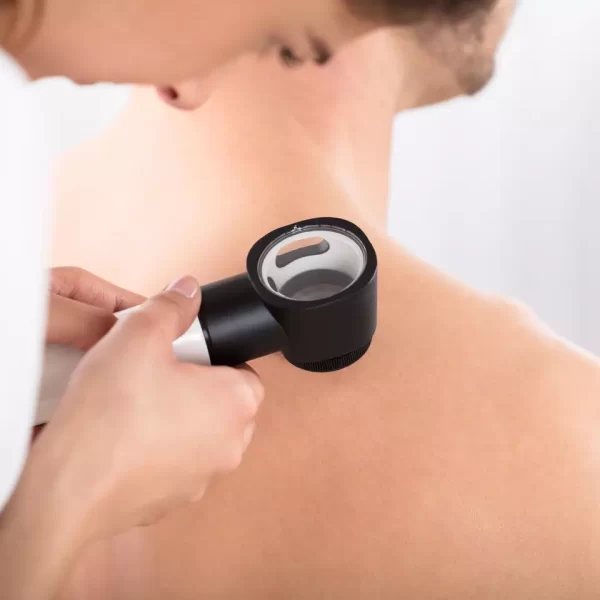 Nursing in the Treatment of Skin Lesions 2