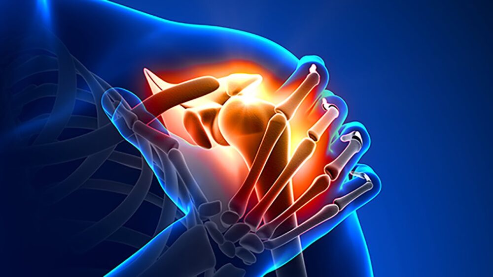 Pós-Graduação em Reumatologia - Image 2